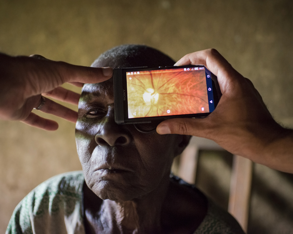 In a rural home, a person's retina is scanned using a smartphone camera 