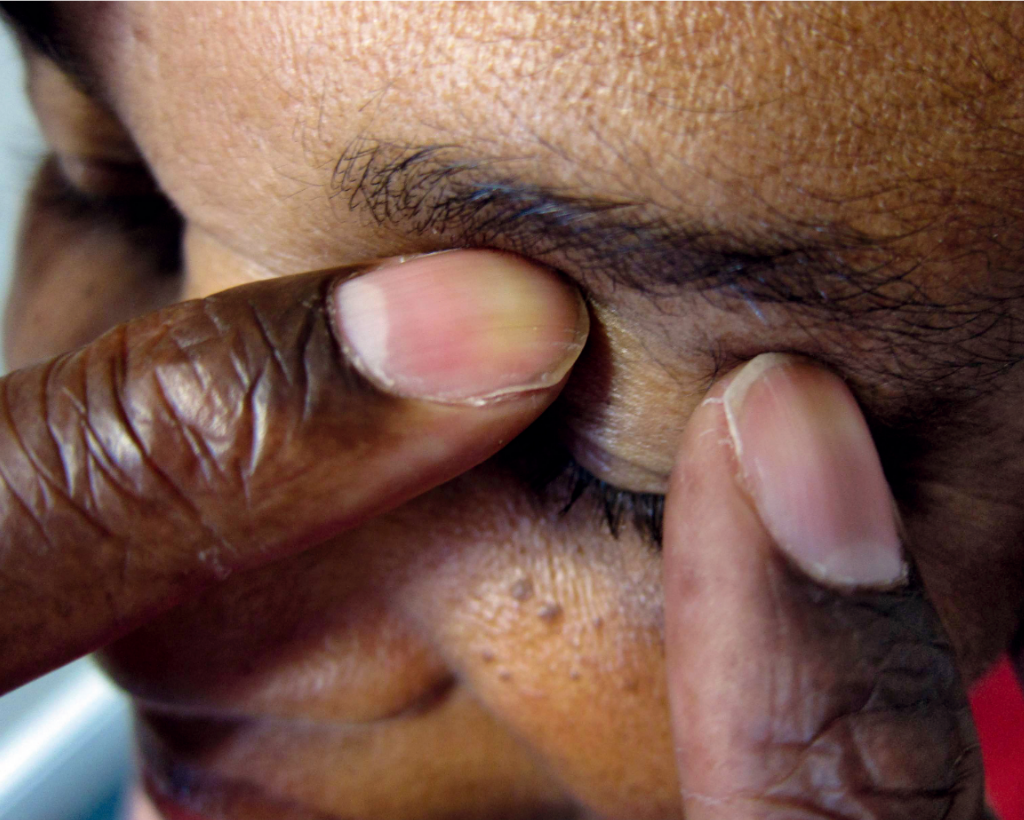 a person has their eye pressure checked by hand 