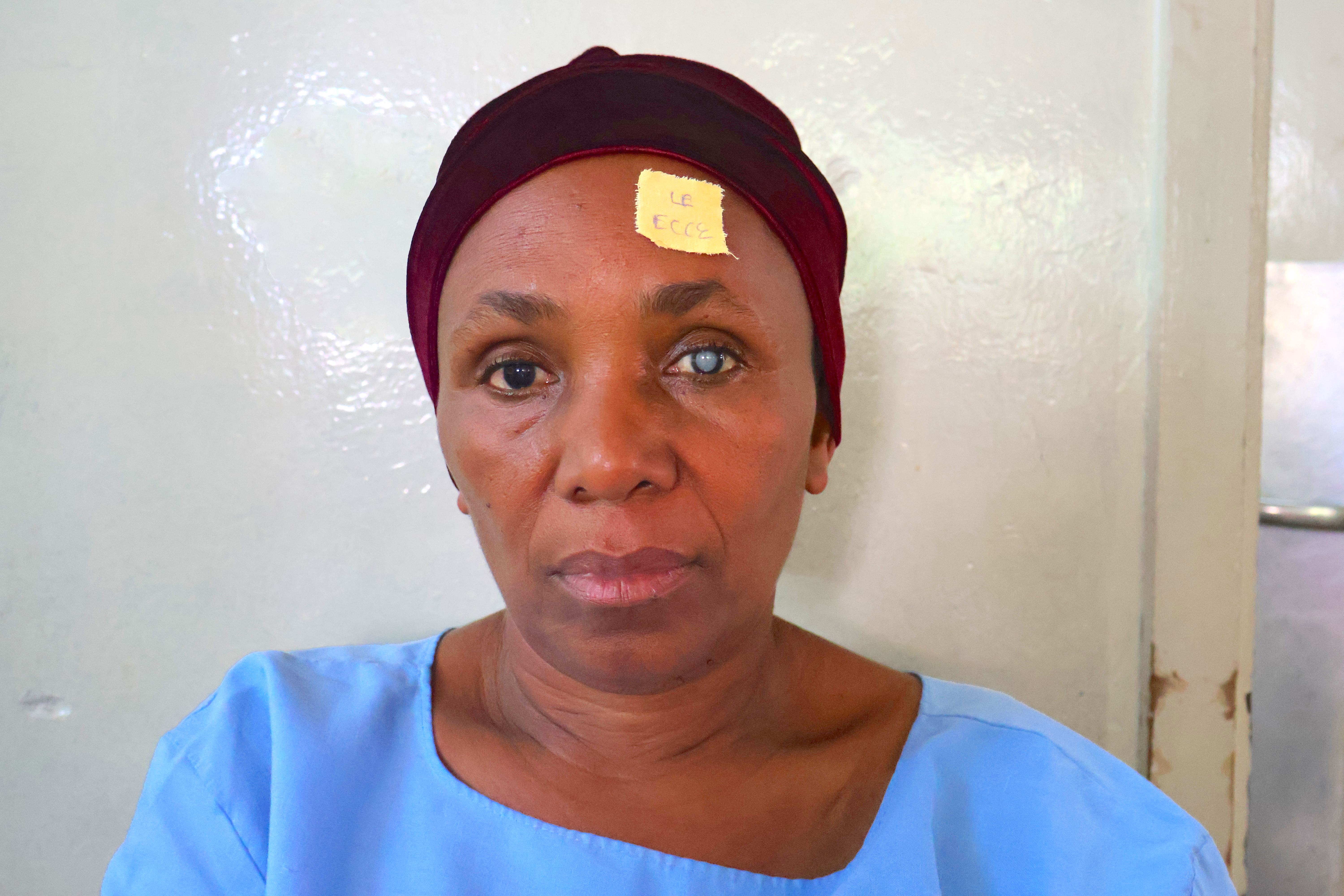 In Tanzania, a woman with a cataract is ready for surgery