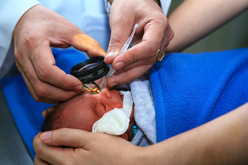 a baby has their eye checked 