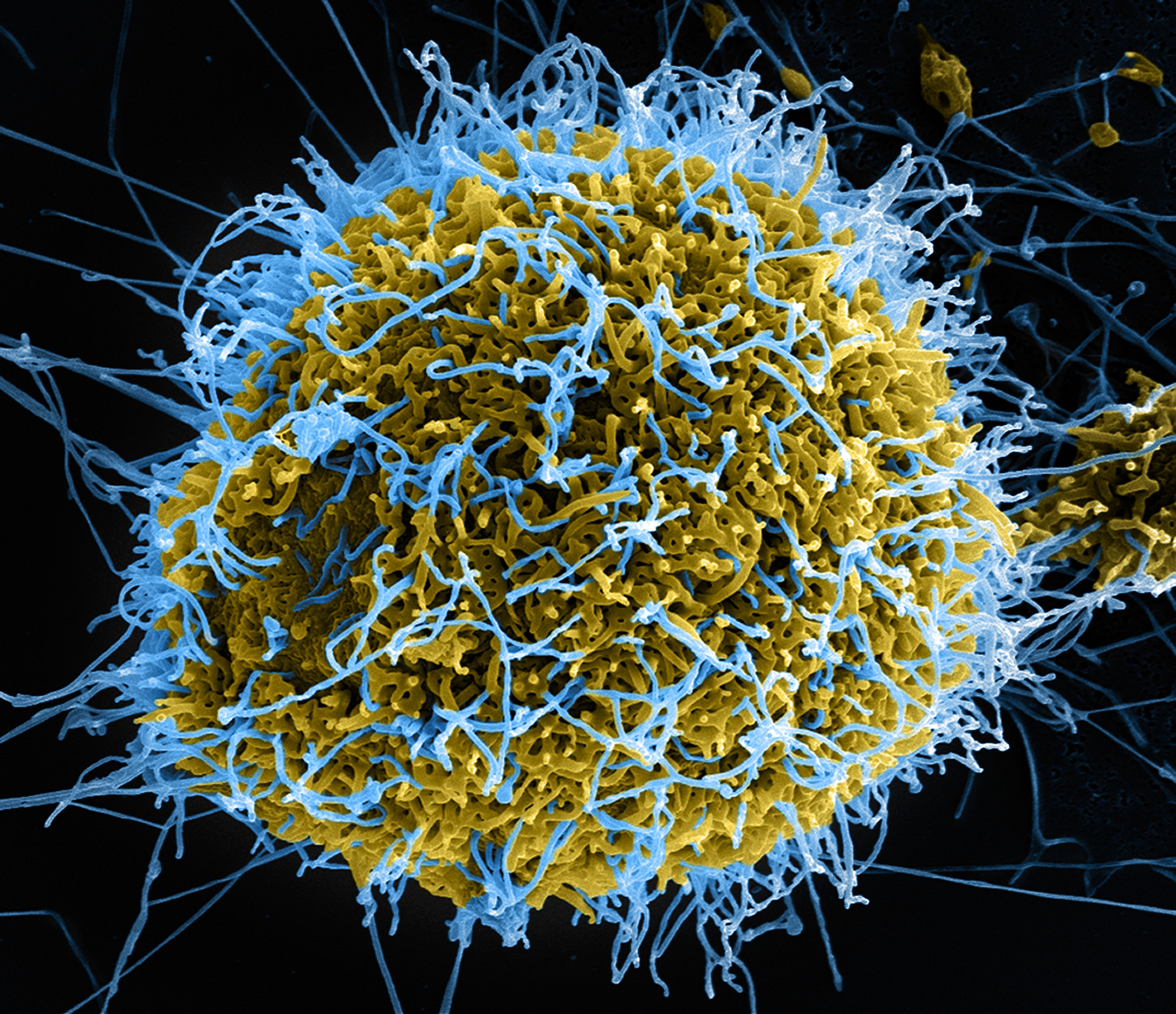 Ebola Virus Particles by NIAID