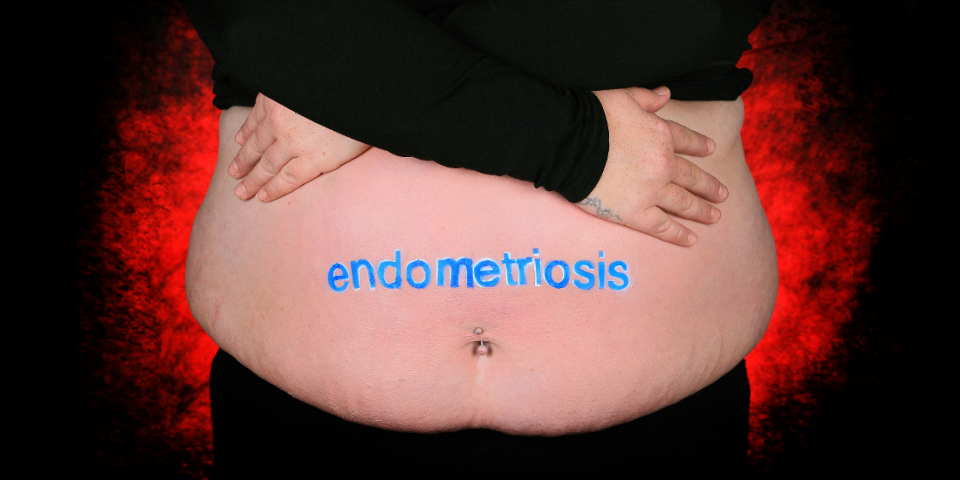 endo-960×480-1