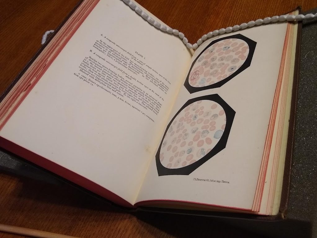 A photograph of pages from 'Two monographs on malaria and the parasites of malarial fevers' including colour plate illustrations of blood samples.