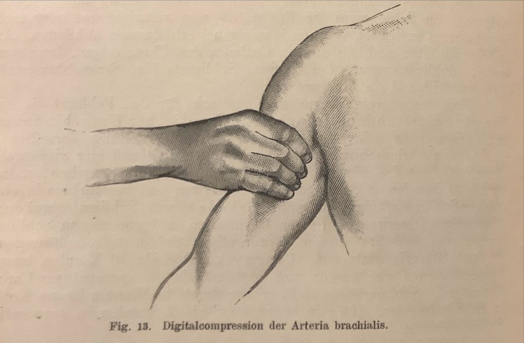 Printed illustration of a hand compressing a shoulder, with the German caption "Digitalcompression der Arteria brachialis".