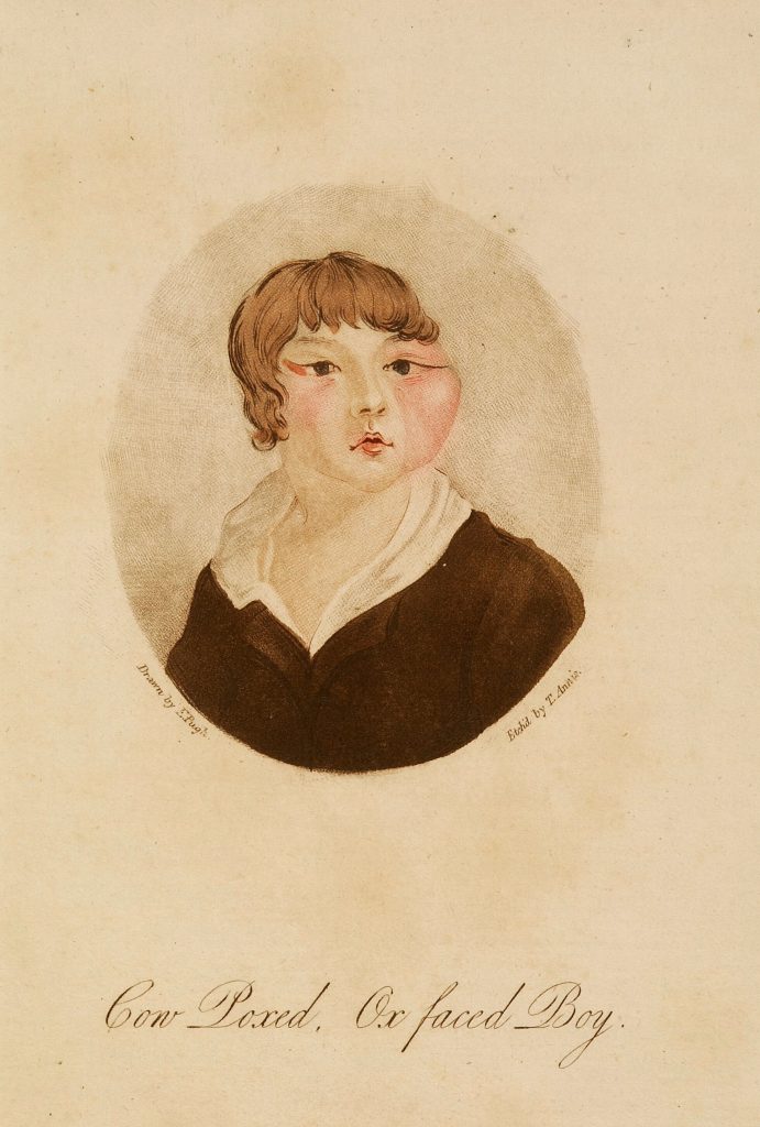 an image of the ox faced boy